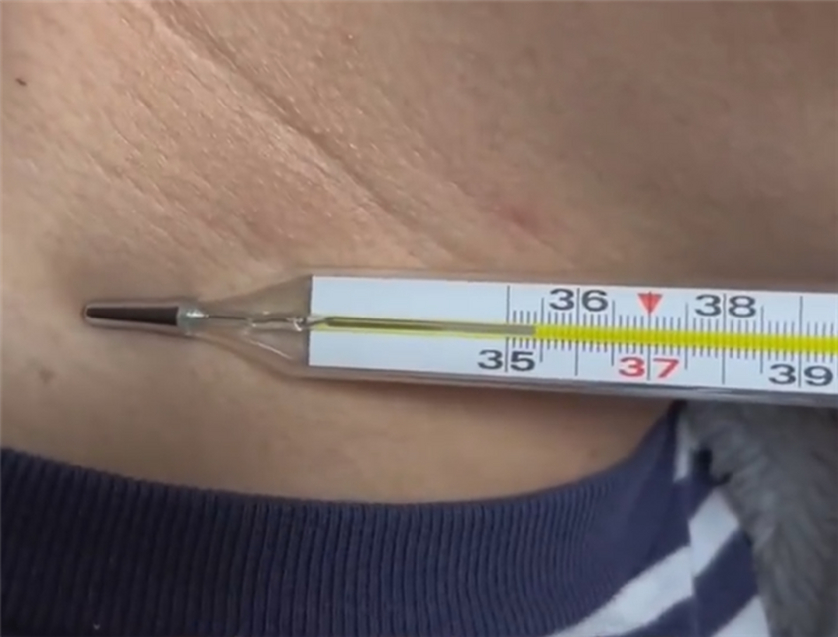 疫情测试体温】