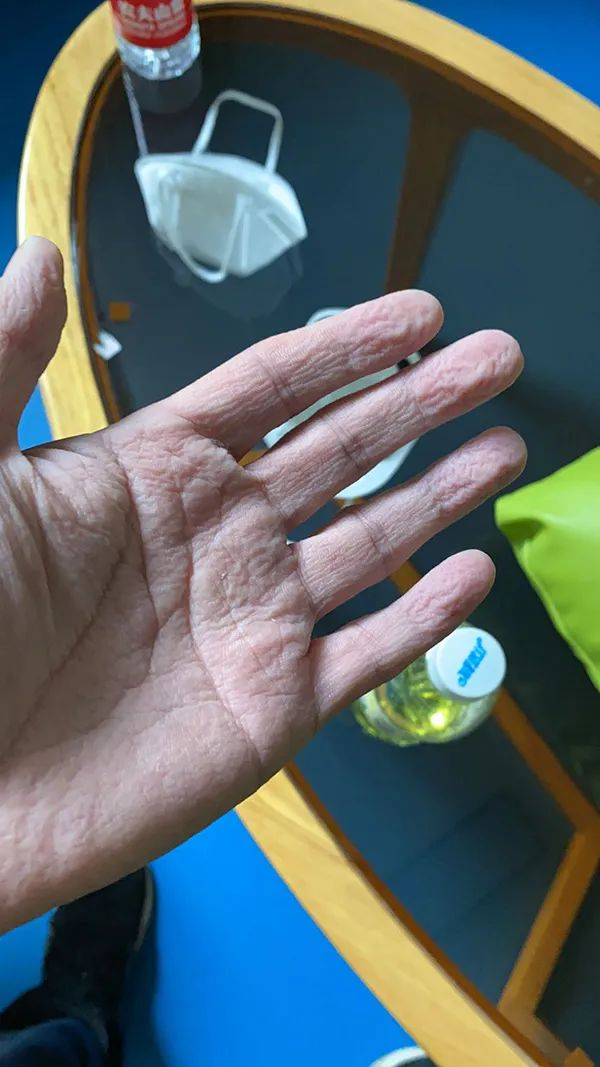 【新冠疫情症状初期