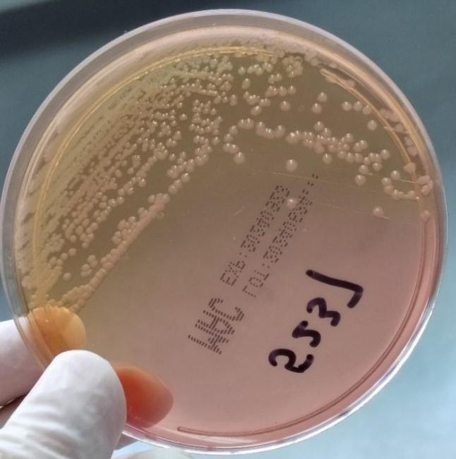 沙门氏菌疫情蔓延】